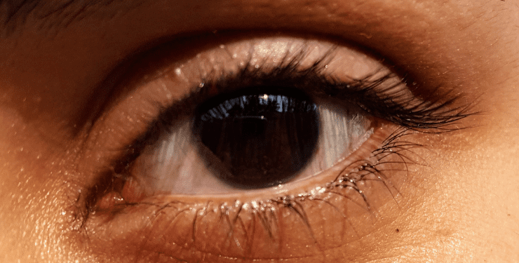 Avances esperanzadores en la lucha contra la aniridia