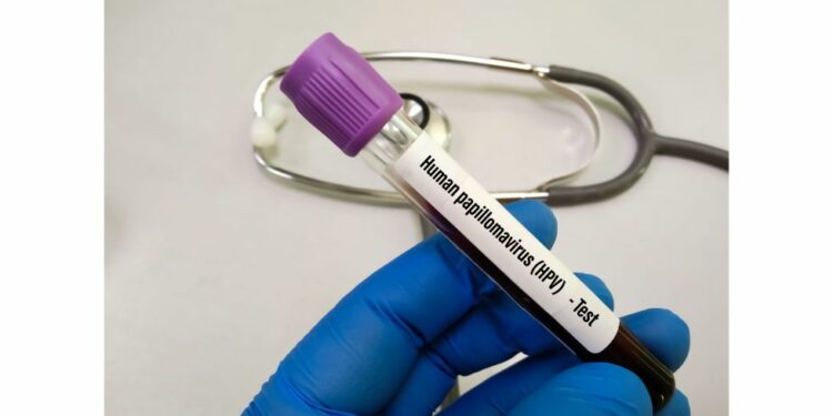 Virus del Papiloma Humano eleva riesgo cardíaco según nuevo estudio global