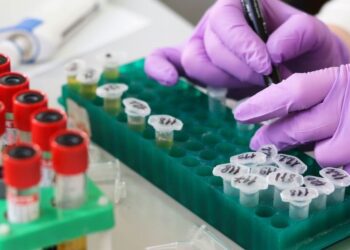 Hallazgo de biomarcadores anticipa diabetes tipo 2 siete años antes